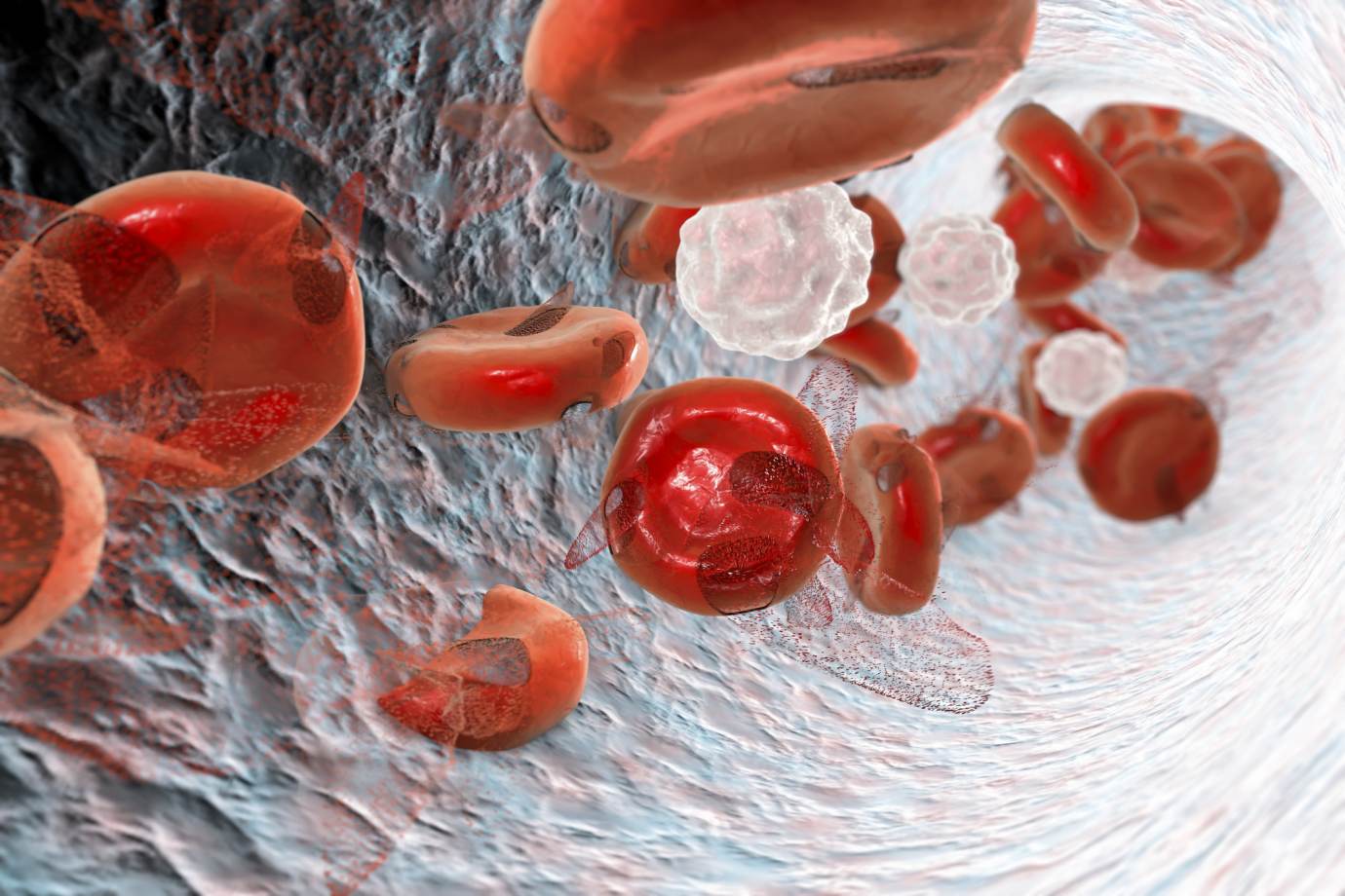 res Niedokrwistość (anemia)- przyczyny, objawy, leczenie, zapobieganie
