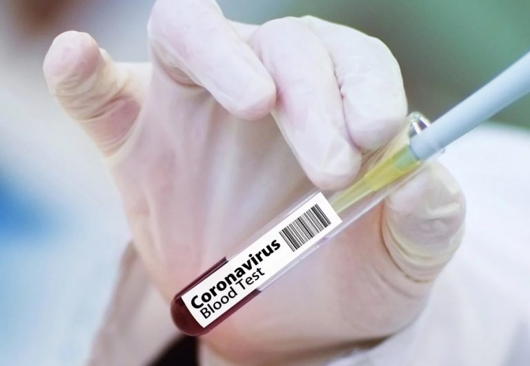 4 nowe przypadki koronawirusa na Lubelszczyźnie. W kraju zmarły kolejne dwie osoby.